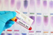Test do wykrywania koronawirusa wprowadzony przez polską firmę