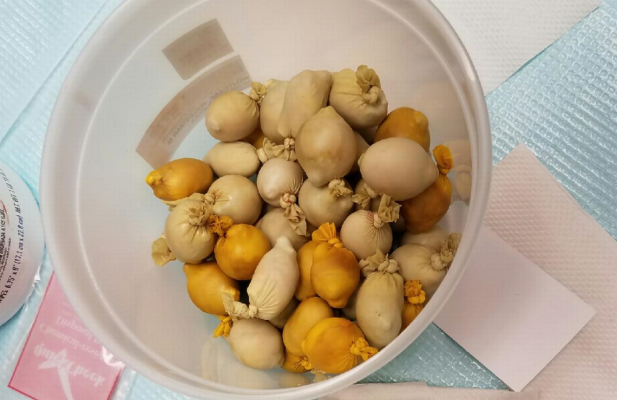 3-7f3f97e62b0e8b8c7857b664a091ddd9_ae1860 3-7f3f97e62b0e8b8c7857b664a091ddd9_ae1860